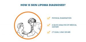 get rid of lipoma